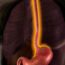 Barrett’s Esophagus: Symptoms, Causes, and Prevention